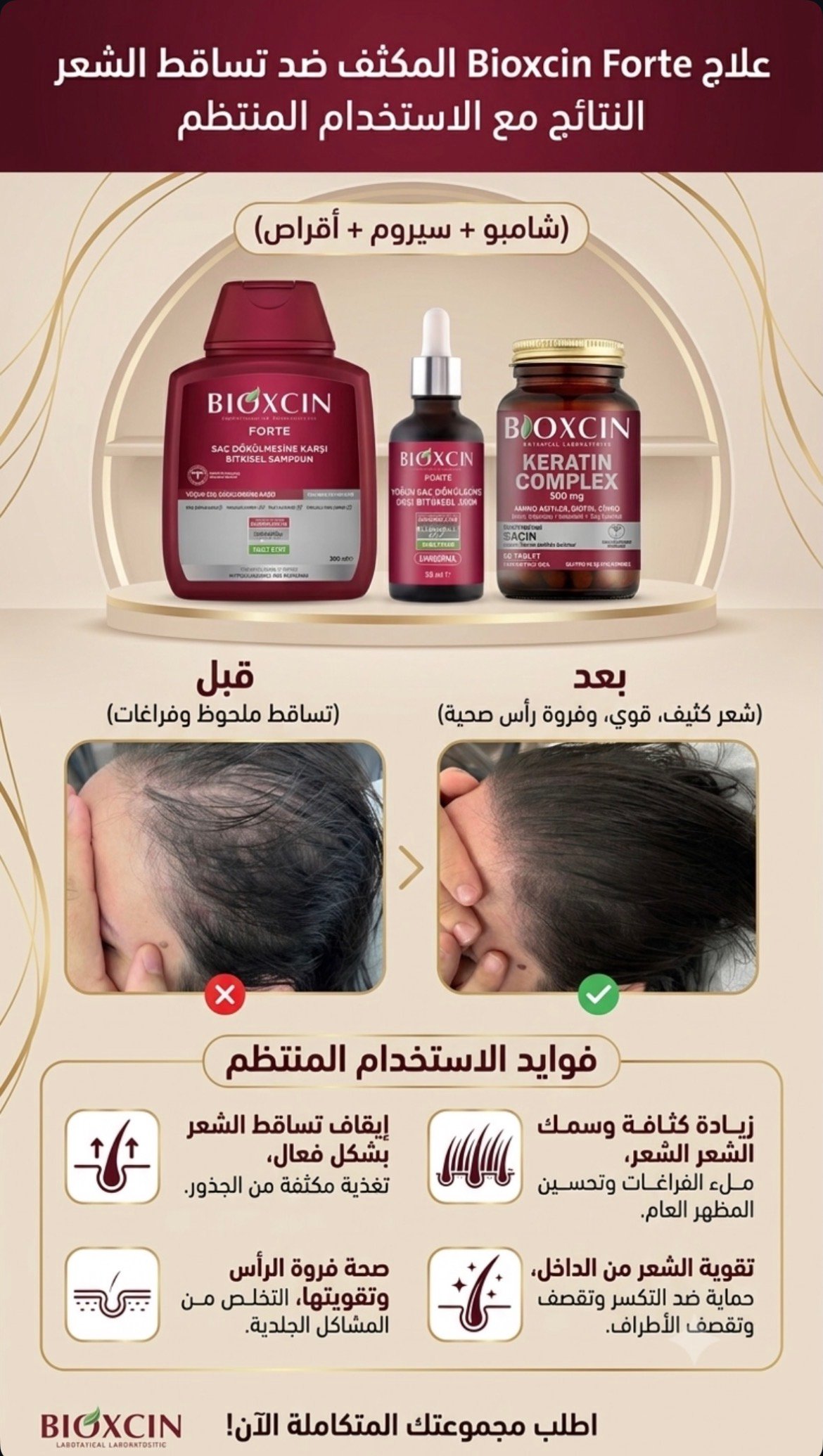Screenshot Bioxcin Forte – مجموعة لتساقط الشعر - الصورة 1